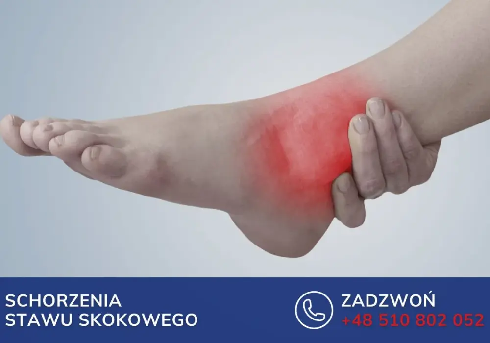 Ból po zewnętrznej stronie stopy - uraz czy przeciążenie?