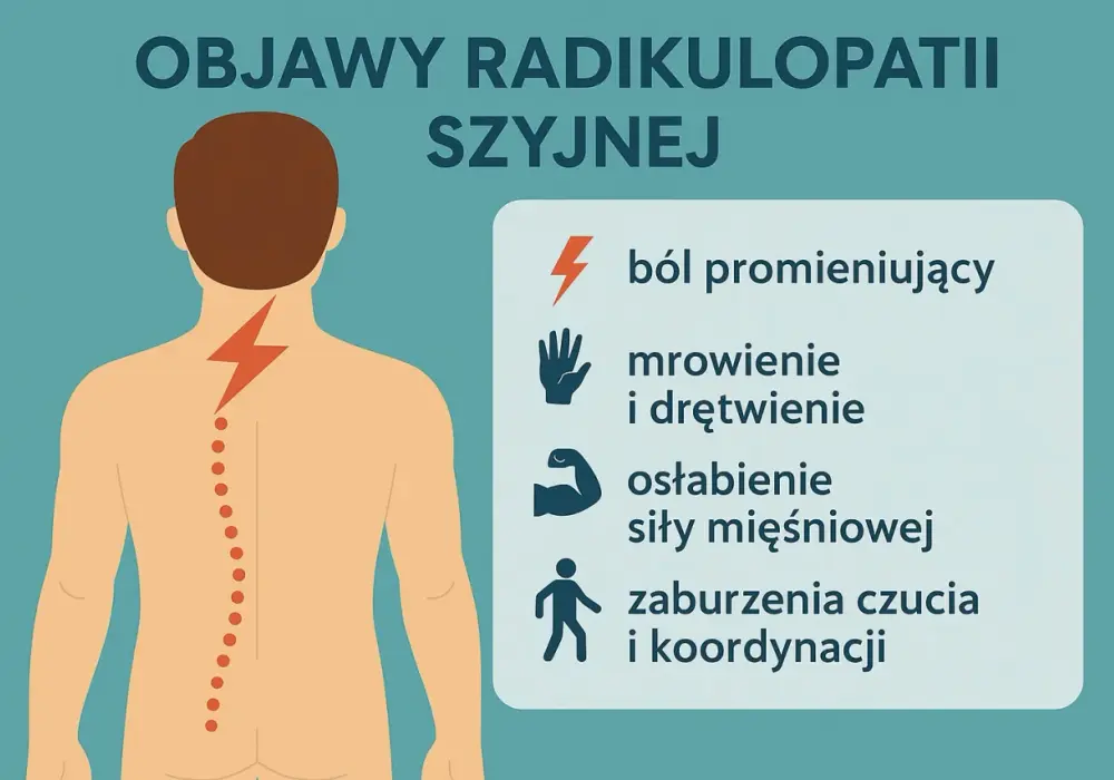 Korzenie i sploty nerwowe - objawy, przyczyny, leczenie