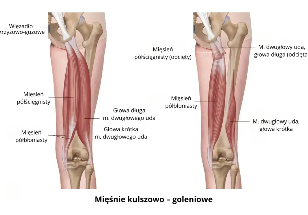 Ból z tyłu uda? Poznaj mięśnie kulszowo-goleniowe!