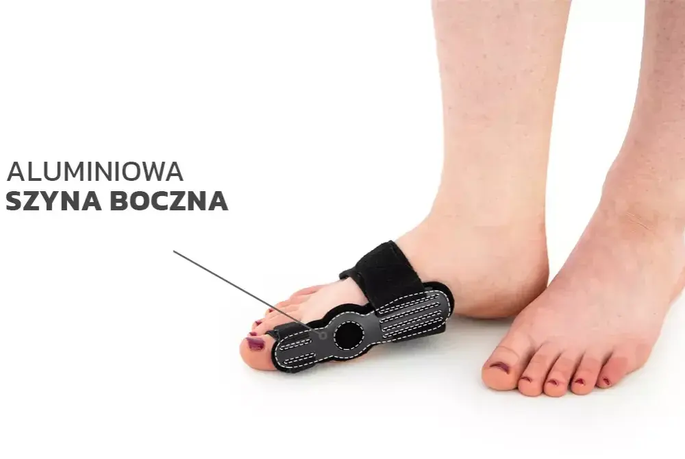 Czy ortezy na haluksy działają? Odkryj ich prawdziwe efekty