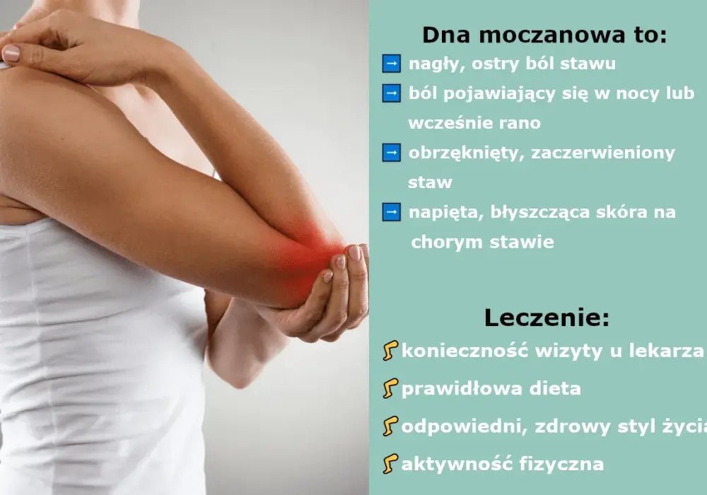 Dna moczanowa - objawy, leczenie i co robić w ostrym bólu