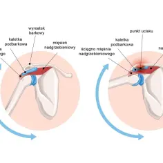 Anatomia barku: przywodziciel i odwodziciel. Mięsień nadgrzebieniowy, ścięgno, kaletka podbarkowa i wyrostek barkowy. Po prawej punkt ucisku.