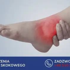 Ból w stopie z boku zewnętrznej strony, czerwony obszar wskazuje na problem ze stawem skokowym.