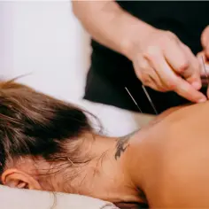 Terapeuta aplikuje igły do akupunktury. Choć zabieg jest zazwyczaj bezpieczny, warto znać potencjalne suche igłowanie skutki uboczne.