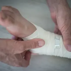 Skręcona kostka: ile L4 na zwolnieniu i co wpływa na czas?