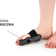 Czy ortezy na haluksy działają? Odkryj ich prawdziwe efekty
