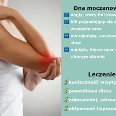 Dna moczanowa to nagły, ostry ból stawu, obrzęk i zaczerwienienie. Leczenie obejmuje wizytę u lekarza, dietę i aktywność fizyczną.