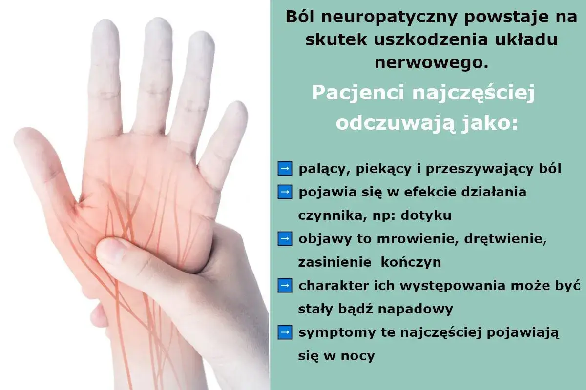 Dłoń z zaznaczonymi nerwami, odczuwająca palący ból, objaw allodynii.