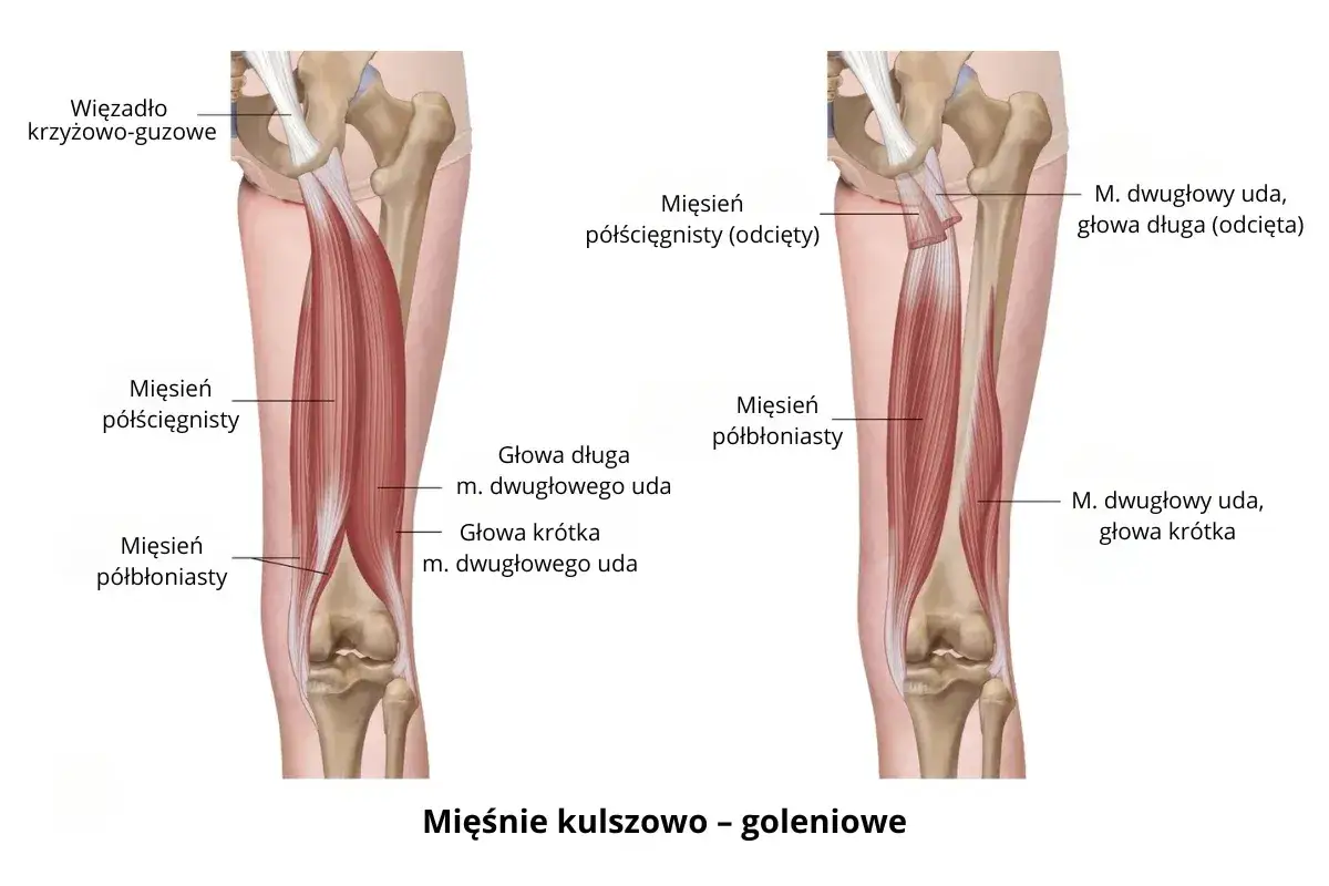 Anatomia mięśni kulszowo-goleniowych: mięsień półścięgnisty i półbłoniasty, z uwzględnieniem głowy długiej i krótkiej mięśnia dwugłowego uda.