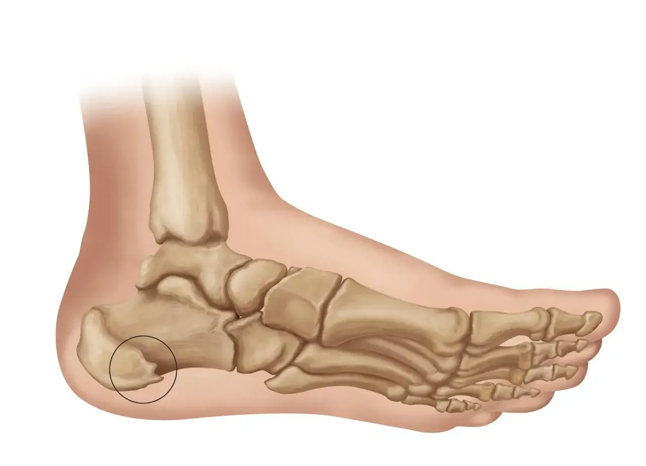 Anatomia stopy z zaznaczoną kością piętową.