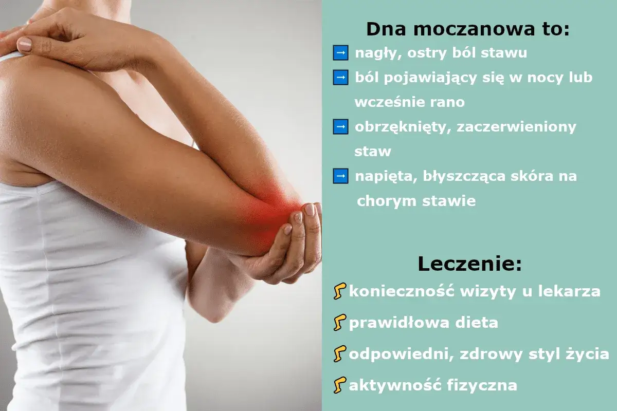 Dna moczanowa to nagły, ostry ból stawu, obrzęk i zaczerwienienie. Leczenie obejmuje wizytę u lekarza, dietę i aktywność fizyczną.