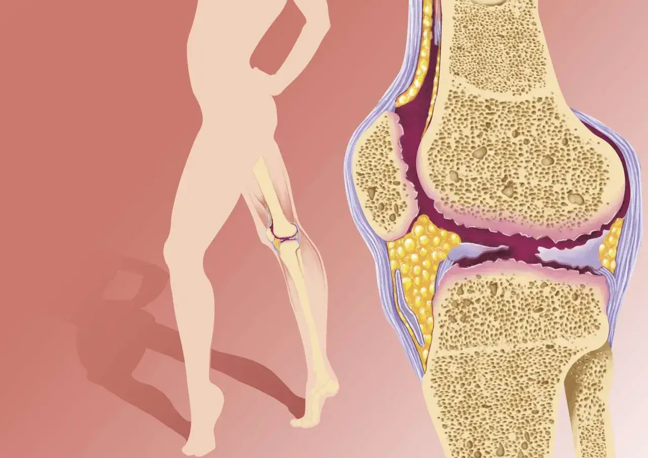 Anatomia kolana z widoczną guzowatością kości piszczelowej.