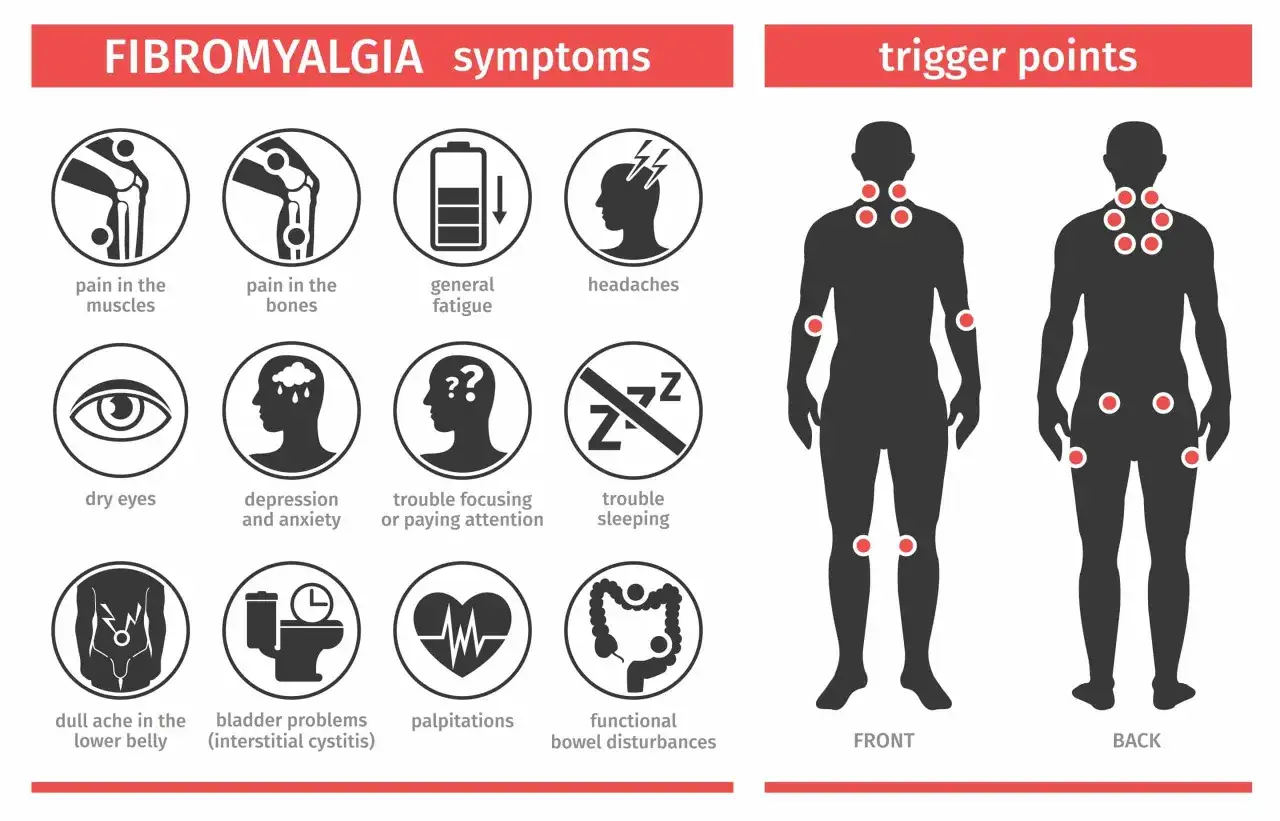 Fibromialgia co to? Objawy: ból mięśni, kości, zmęczenie, bóle głowy, suchość oczu, problemy ze snem, koncentracją, trawieniem. Punkty spustowe na ciele.