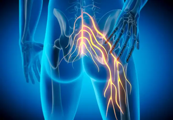 Nerw pośrodkowy - anatomia, objawy i jak go chronić?