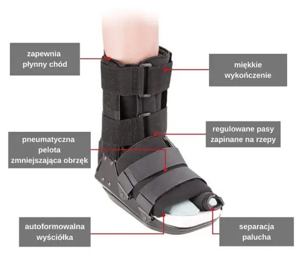 Kiedy normalne buty po operacji haluksa? Sprawdź, aby uniknąć bólu
