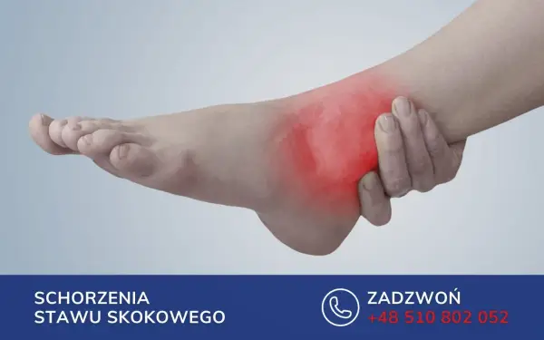 Ból po zewnętrznej stronie stopy - uraz czy przeciążenie?
