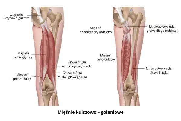Ból z tyłu uda? Poznaj mięśnie kulszowo-goleniowe!