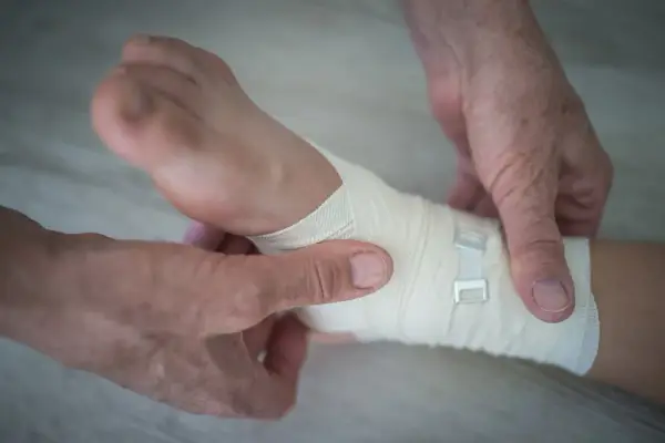 Skręcona kostka: ile L4 na zwolnieniu i co wpływa na czas?