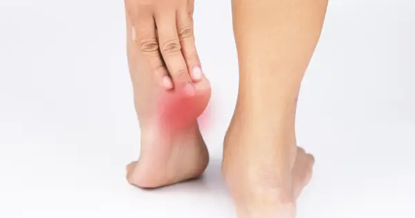 Skuteczne domowe sposoby na ból pięty - Kiedy do lekarza?