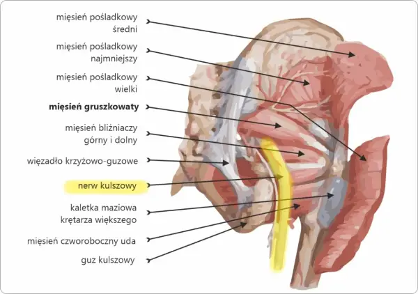 Ból pośladka - Zespół mięśnia gruszkowatego czy rwa?