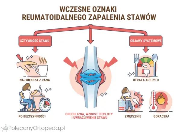 Gościec (RZS) - Objawy, leczenie i kiedy do ortopedy?